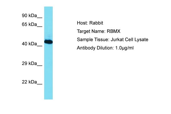 Polyclonal Rabbit anti-Human RBMX Antibody (aa210-259, WB)
