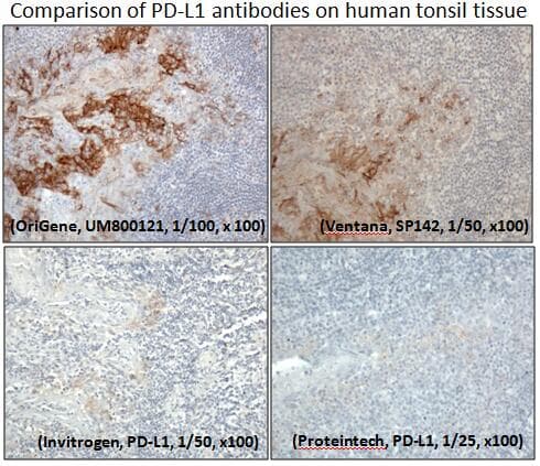 CD274 / B7-H1 / PD-L1 Antibody (aa19-290, clone UMAB229)