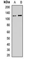 Polyclonal Rabbit anti-Human USP28 Antibody (WB)