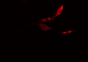 EIF3K Antibody