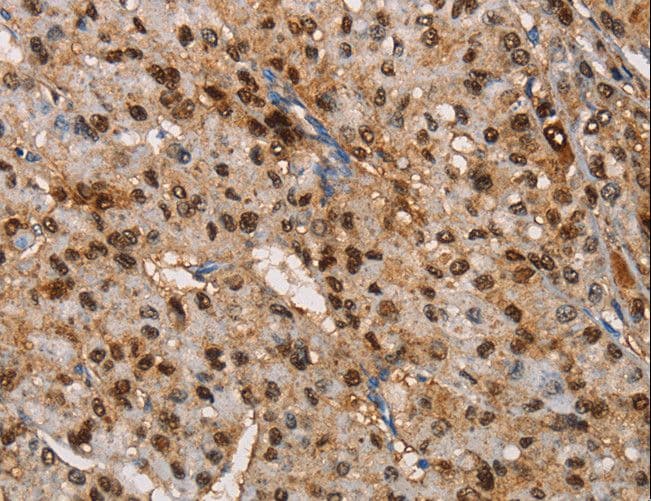 TSPEAR Antibody