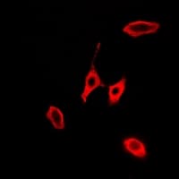 KLK10 / Kallikrein 10 Antibody