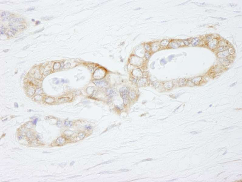 USP3 / UBP Antibody (aa471-521)