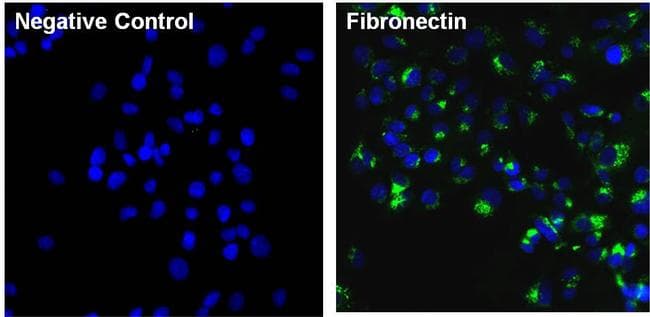 FN1 / Fibronectin Antibody (clone 3F12)