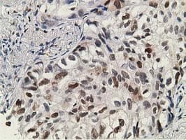 DCK / Deoxycytidine kinase Antibody (clone OTI16G6, Carrier-free)