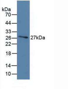 GC / Vitamin D-Binding Protein Antibody