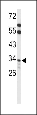 Polyclonal Rabbit anti-Human ACOT8 Antibody (aa290-319, IHC, WB)