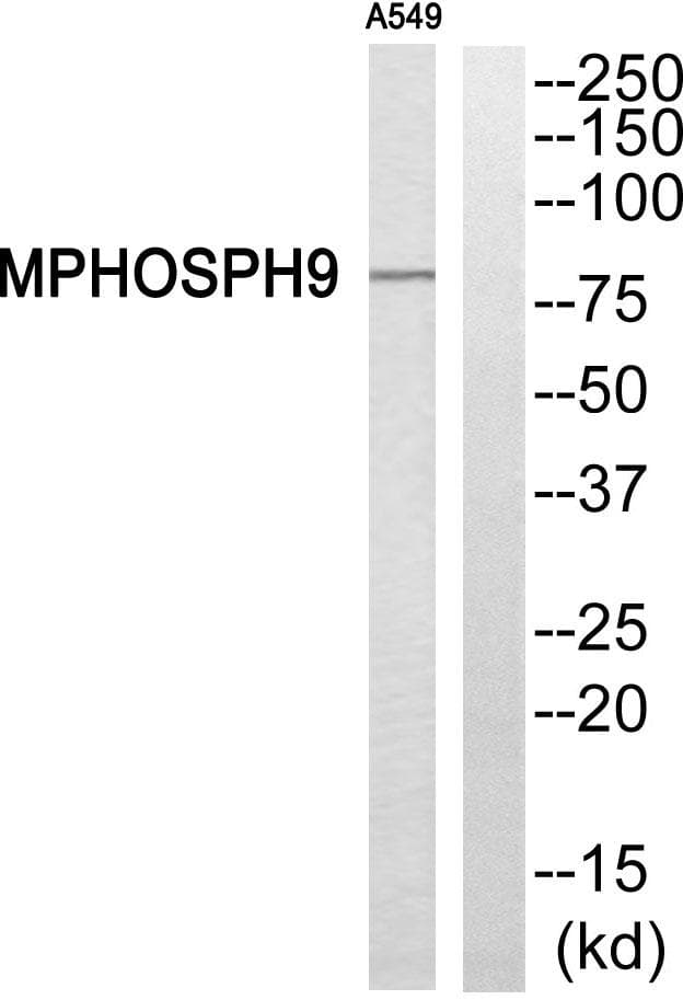 Polyclonal Rabbit anti-Human MPHOSPH9 Antibody (WB)