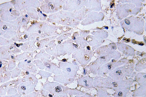 Polyclonal Rabbit anti-Human LBC / AKAP13 Antibody (Asp738, IHC, WB)