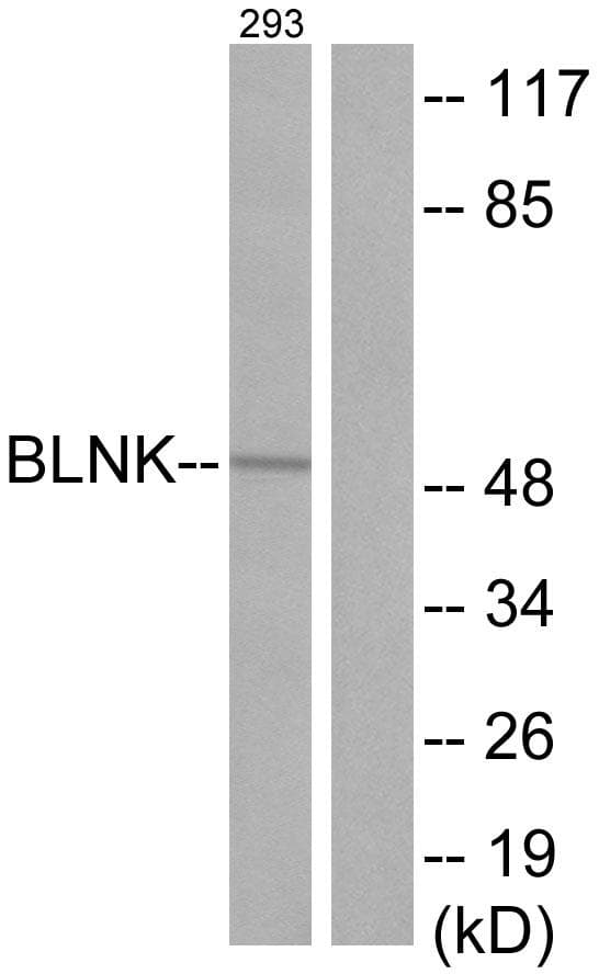 BLNK Antibody (p96)