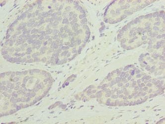 ODF3L1 Antibody