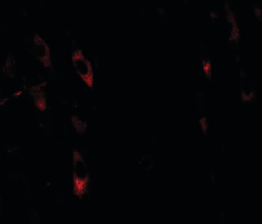 LRRTM1 Antibody