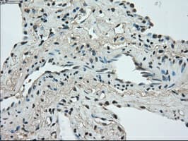 STK39 / SPAK Antibody (clone OTI3C12)
