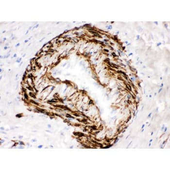 SMYD3 Antibody (aa388-428)