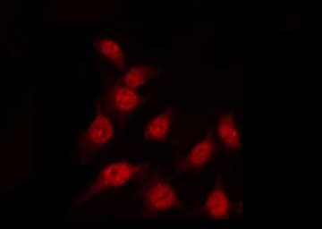 DUSP1 / MKP1 Antibody (phospho-Ser296,pSer318)