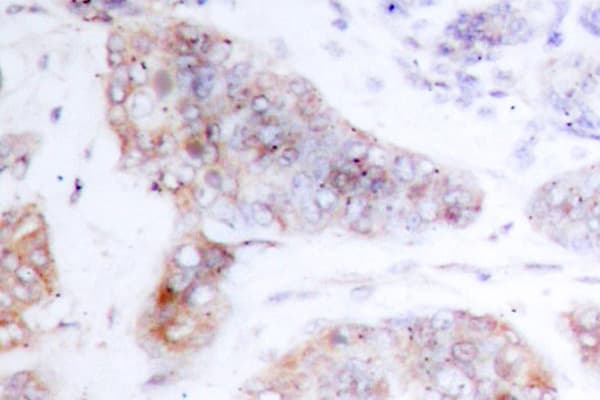 Polyclonal Rabbit anti-Human RAF1 / RAF Antibody (Gln253, IHC, WB)