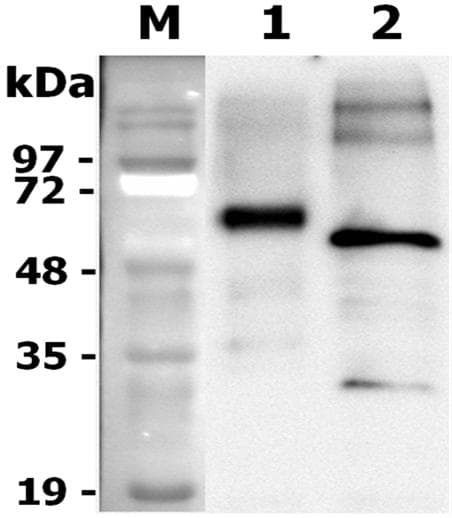 Rat GRN / Granulin Protein (Recombinant DDK (Flag))