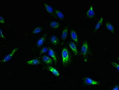 SPCS2 Antibody
