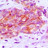 EGFR Antibody (C-Terminus)