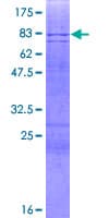 Human AMY2B Protein (Recombinant GST)