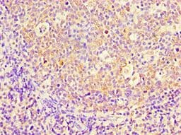 PBK / TOPK Antibody (aa1-322)