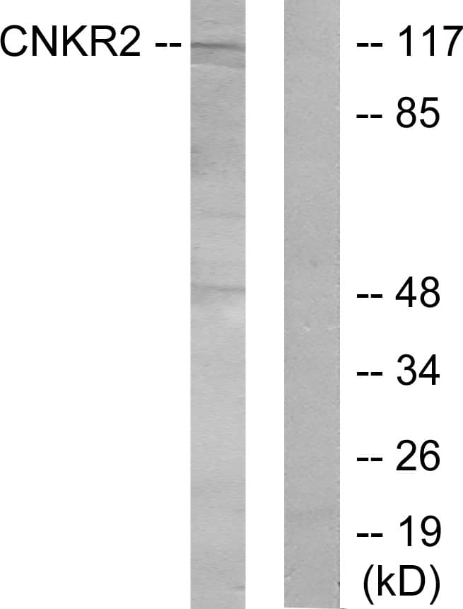 Polyclonal Rabbit anti-Human CNKSR2 Antibody (aa641-690, WB)