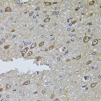 Polyclonal Rabbit anti-Human IF3mt / MTIF3 Antibody (IHC, WB)