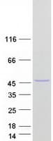 Human CCBL2 Protein (Recombinant Myc-DDK (Flag))