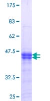 Human PKMYT1 Protein (Recombinant GST, N-terminus)