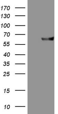 Monoclonal Mouse anti-Human MMP3 Antibody (clone OTI2E7, aa246-477, WB)