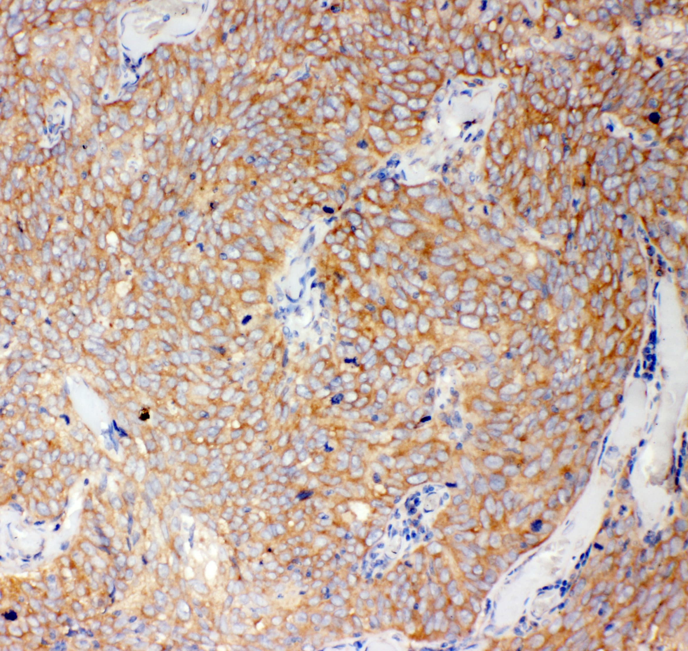 Polyclonal Rabbit anti-Human CASP12 / Caspase 12 Antibody (aa71-84, IHC, WB)