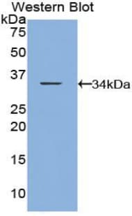 CARD9 Antibody (aa274-530, FITC)