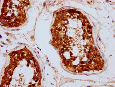 Polyclonal Rabbit anti-Human UBAC2 Antibody (IHC)