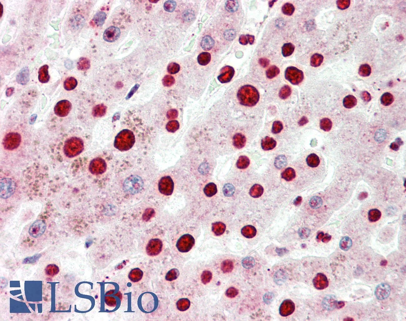 EAR2 / NR2F6 Antibody (N-Terminus)
