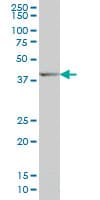 IHC-plus™ Monoclonal Mouse anti-Human DLX2 Antibody (clone 2C8, IHC, WB)