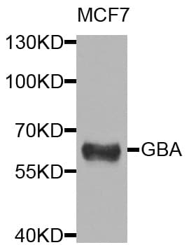 IHC-plus™ Polyclonal Rabbit anti-Human GBA / Glucosidase Beta Acid Antibody (IHC, WB)