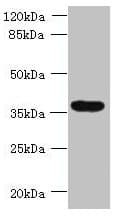 Polyclonal Rabbit anti-Human SPRYD5 Antibody (IHC, WB)