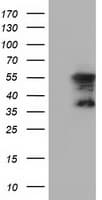 Monoclonal Mouse anti-Human DYNC1LI1 Antibody (clone OTI2B6, IF, WB)