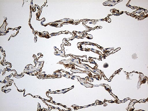 SYNE1 / Nesprin 1 Antibody (aa1-285, clone OTI1E10)