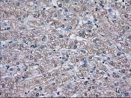 TS / Thromboxane Synthase Antibody (clone OTI1B8)