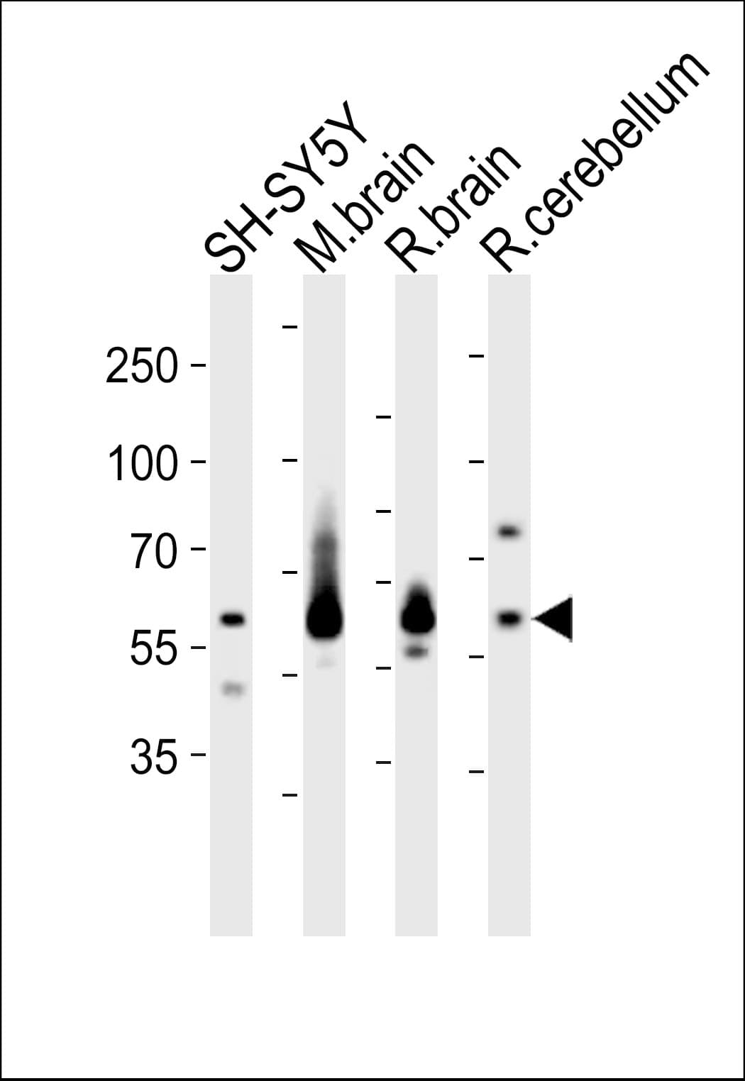 IHC-plus™ SYN1 / Synapsin 1 Antibody (aa668-697)