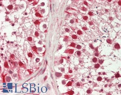 Polyclonal Rabbit anti-Rat CREM / ICER Antibody (C-Terminus, IHC, WB)