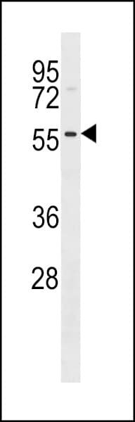 DRAK1 / STK17A Antibody (aa1-30)