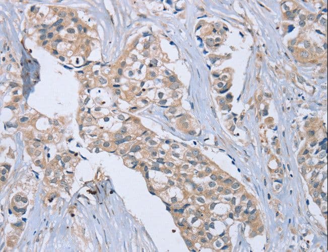 EDA / Ectodysplasin A Antibody