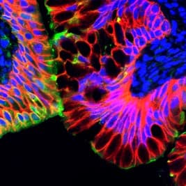 IHC-plus™ Polyclonal Rabbit anti-Human ADGRG2 / GPR64 Antibody (C-Terminus, IHC)