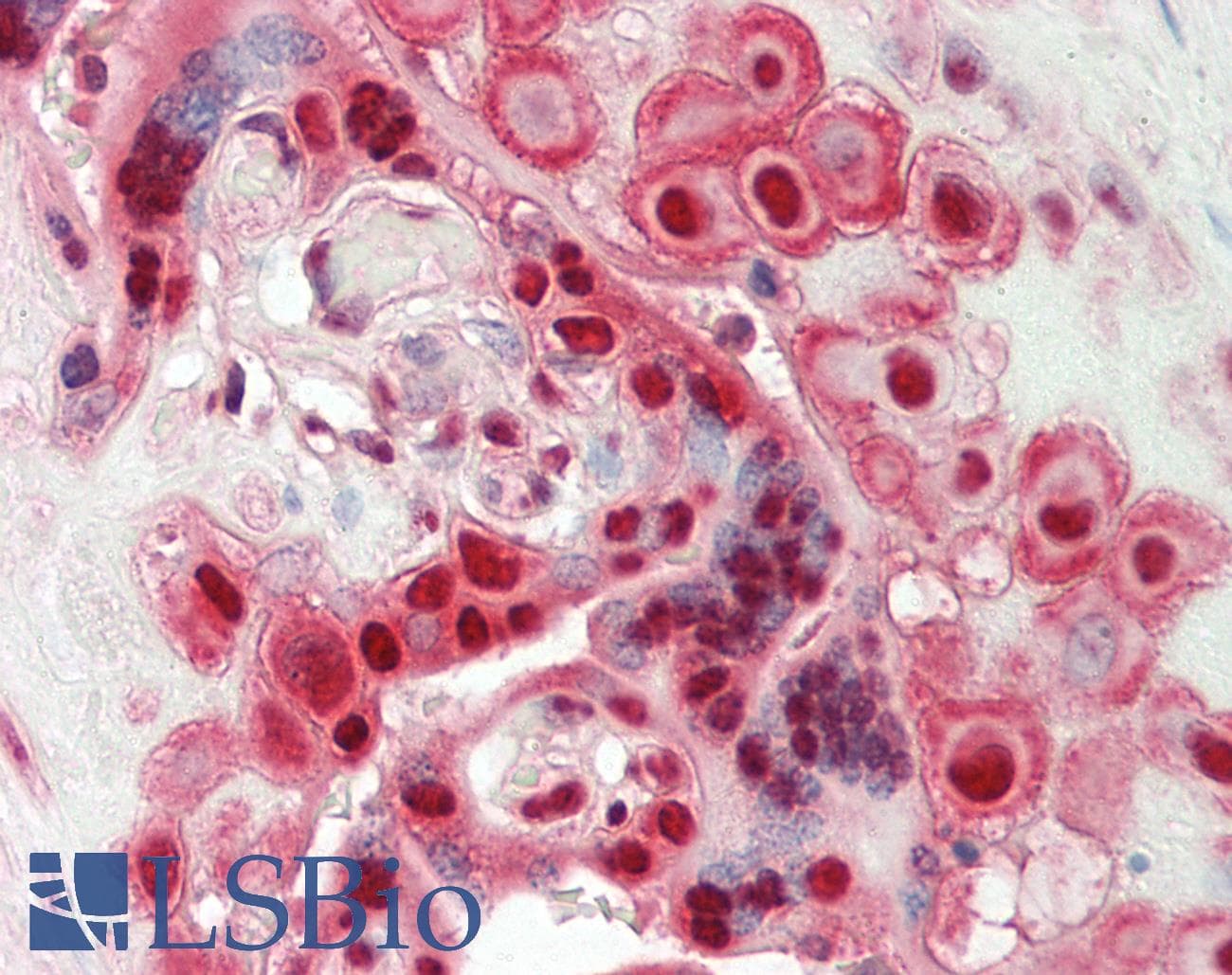 Polyclonal Rabbit anti-Human HNRNPL / hnRNP L Antibody (aa82-131, IHC, WB)