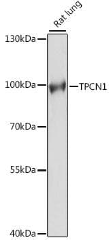 Polyclonal Rabbit anti-Human TPC1 / TPCN1 Antibody (WB)