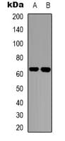 ZNF384 Antibody (N-Terminus)