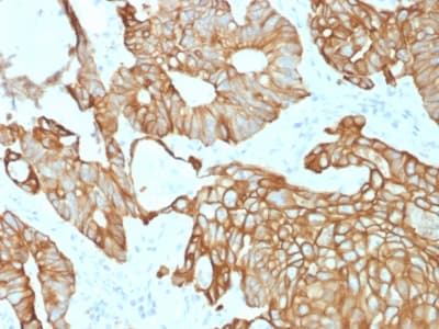 KRT19 / CK19 / Cytokeratin 19 Antibody (clone rKRT19/800, Azide-free, Carrier-free)