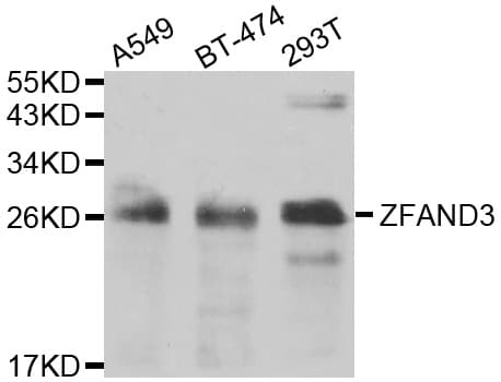 ZFAND3 / TEX27 Antibody
